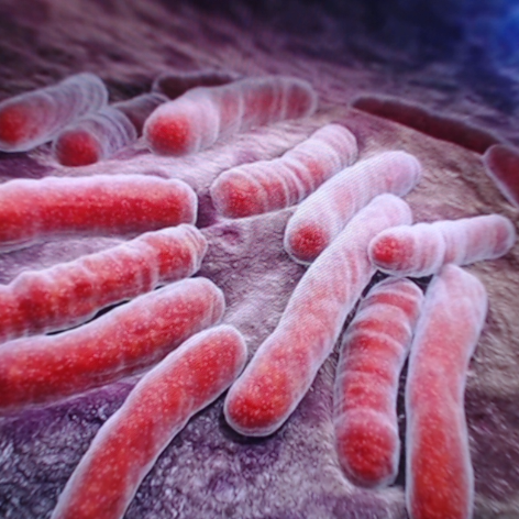 Tuberculosis